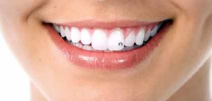 Brillantino al Dente