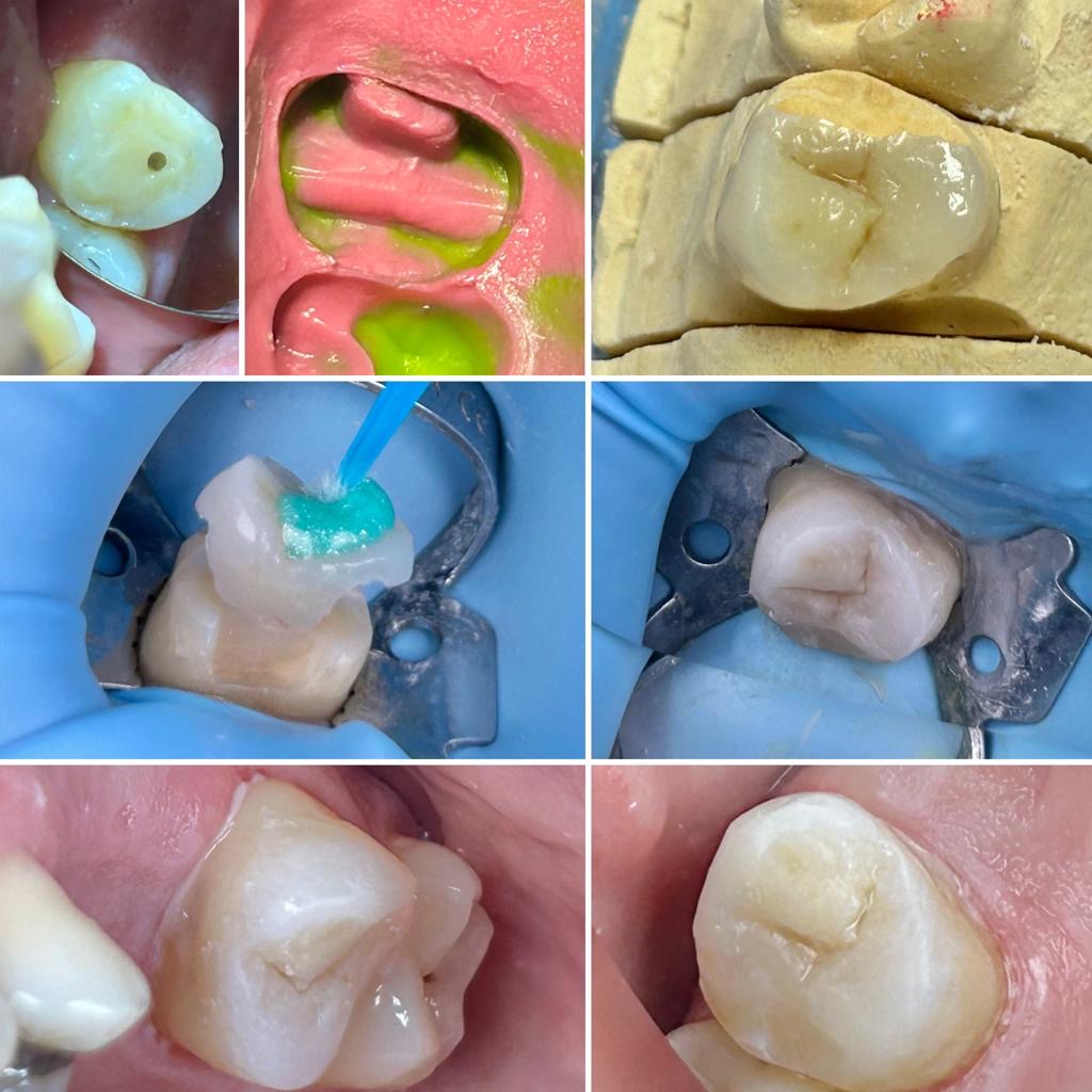Dentista Roma Materiali di qualità