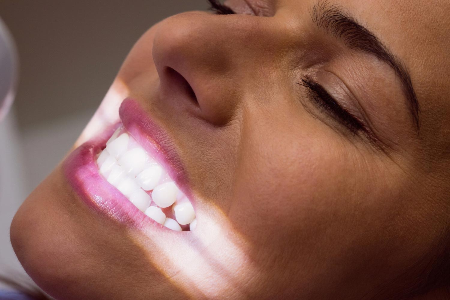 sbiancamento dentale per l’estate