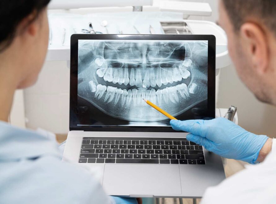 radiografie digitali dentali