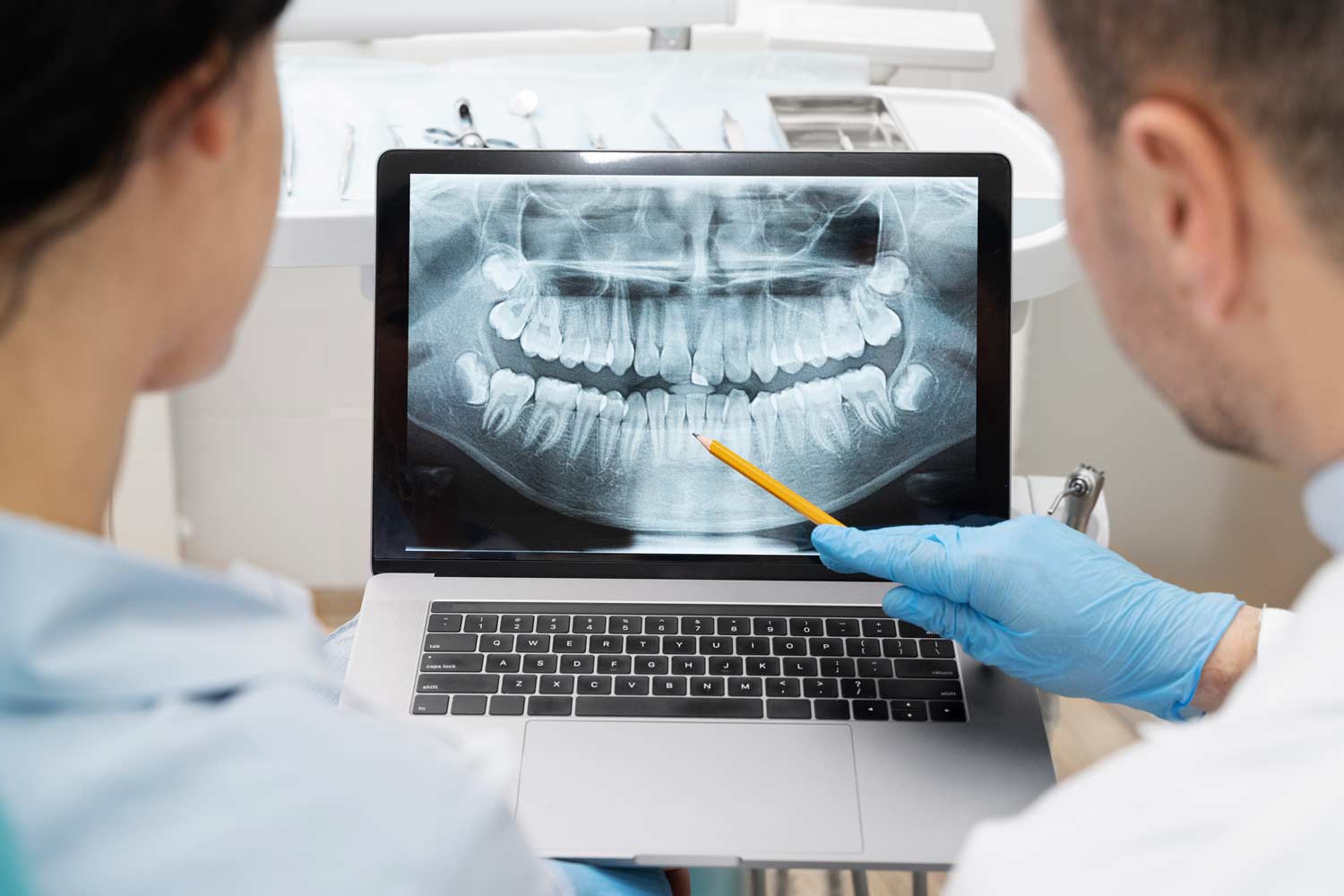 radiografie digitali dentali