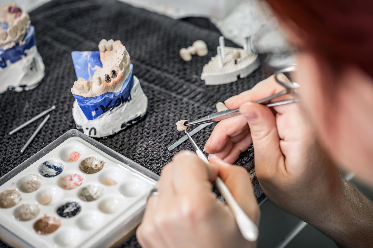 biomateriali dentali
